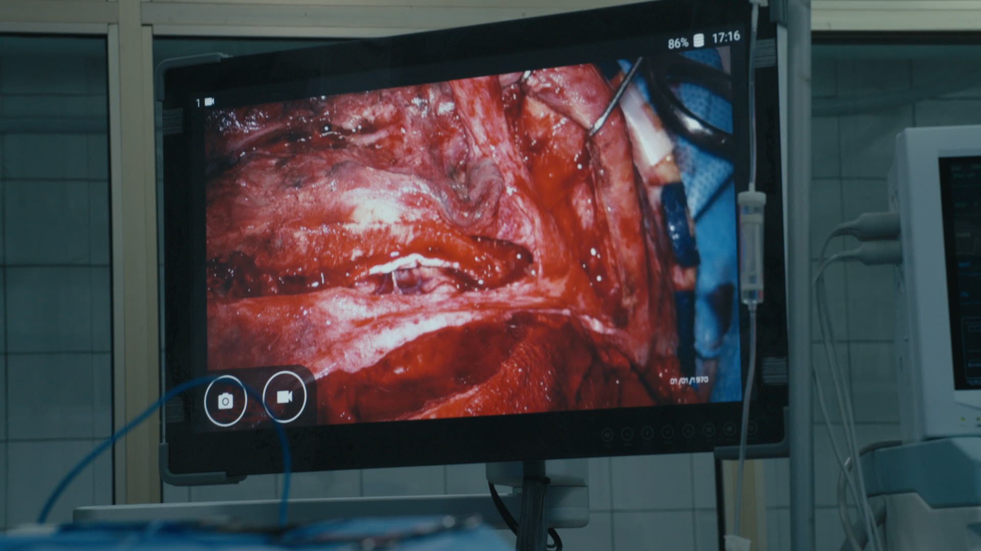 Keyframe: C005C019_200320FP